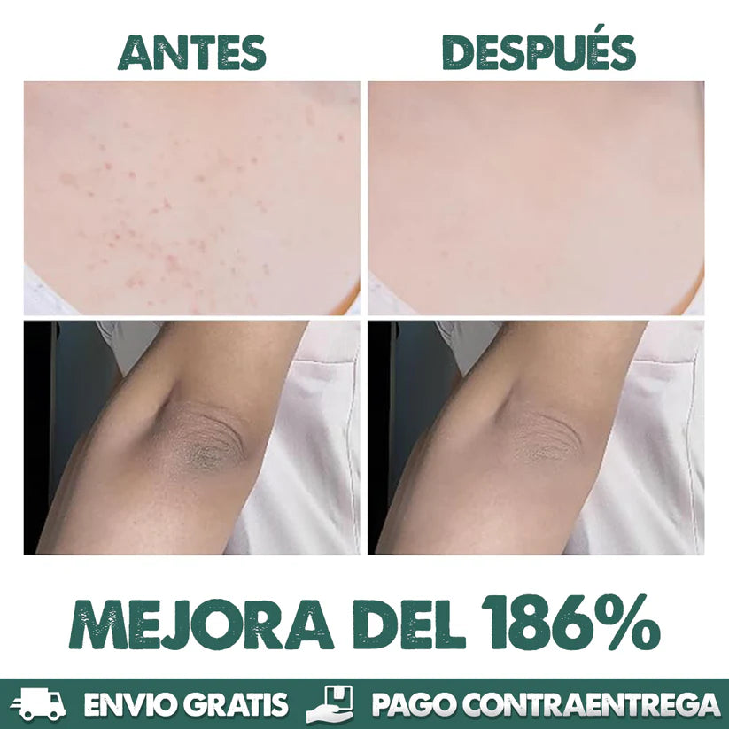 EXFOLIANTE MELAXIN PARA ACLARAR PARTES OSCURAS - FORMULA CURCUMA