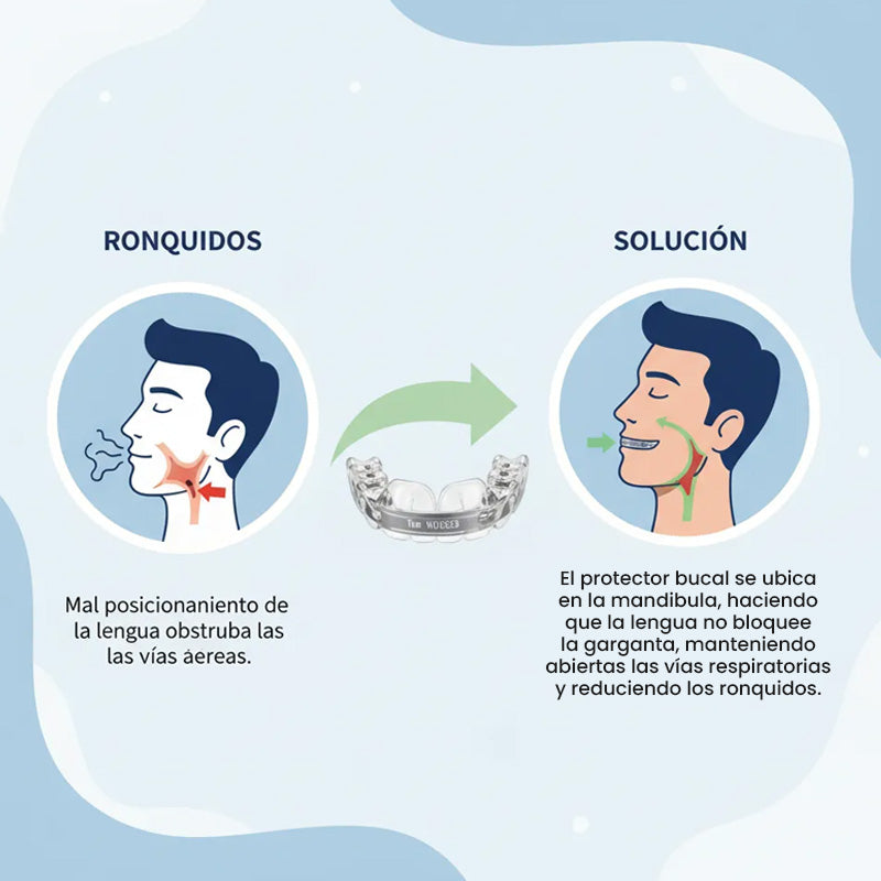 BOQUILLA ANTIRRONQUIDOS