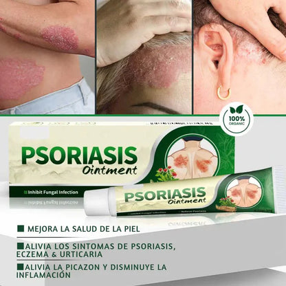OFERTA 2X1, Crema Antifúngica y Antipicazón – Tratamiento Natural para Hongos y Psoriasis