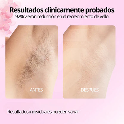 Aceite de Cyperus Rotundus para Reducción del Vello