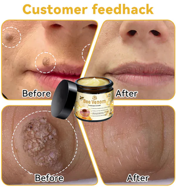Crema de Veneno de Abeja Pro-Retinol: El Secreto Natural para una Piel Firme y Radiante en Semanas.