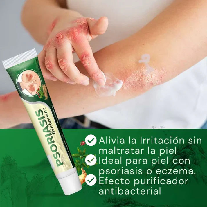 OFERTA 2X1, Crema Antifúngica y Antipicazón – Tratamiento Natural para Hongos y Psoriasis
