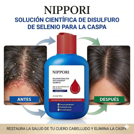 Nippori Shampoo Anticaspa: Tu Cabello Limpio, Fresco y Lleno de Confianza