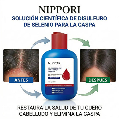 Nippori Shampoo Anticaspa: Tu Cabello Limpio, Fresco y Lleno de Confianza
