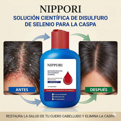 Nippori Shampoo Anticaspa: Tu Cabello Limpio, Fresco y Lleno de Confianza