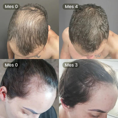 Aceite de Batana ORIGINAL (30ml) + ROMERO | Recupera tu Cabello Perdido EN SOLO 8 SEMANAS.
