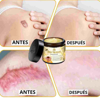 Crema de Veneno de Abeja Pro-Retinol: El Secreto Natural para una Piel Firme y Radiante en Semanas.