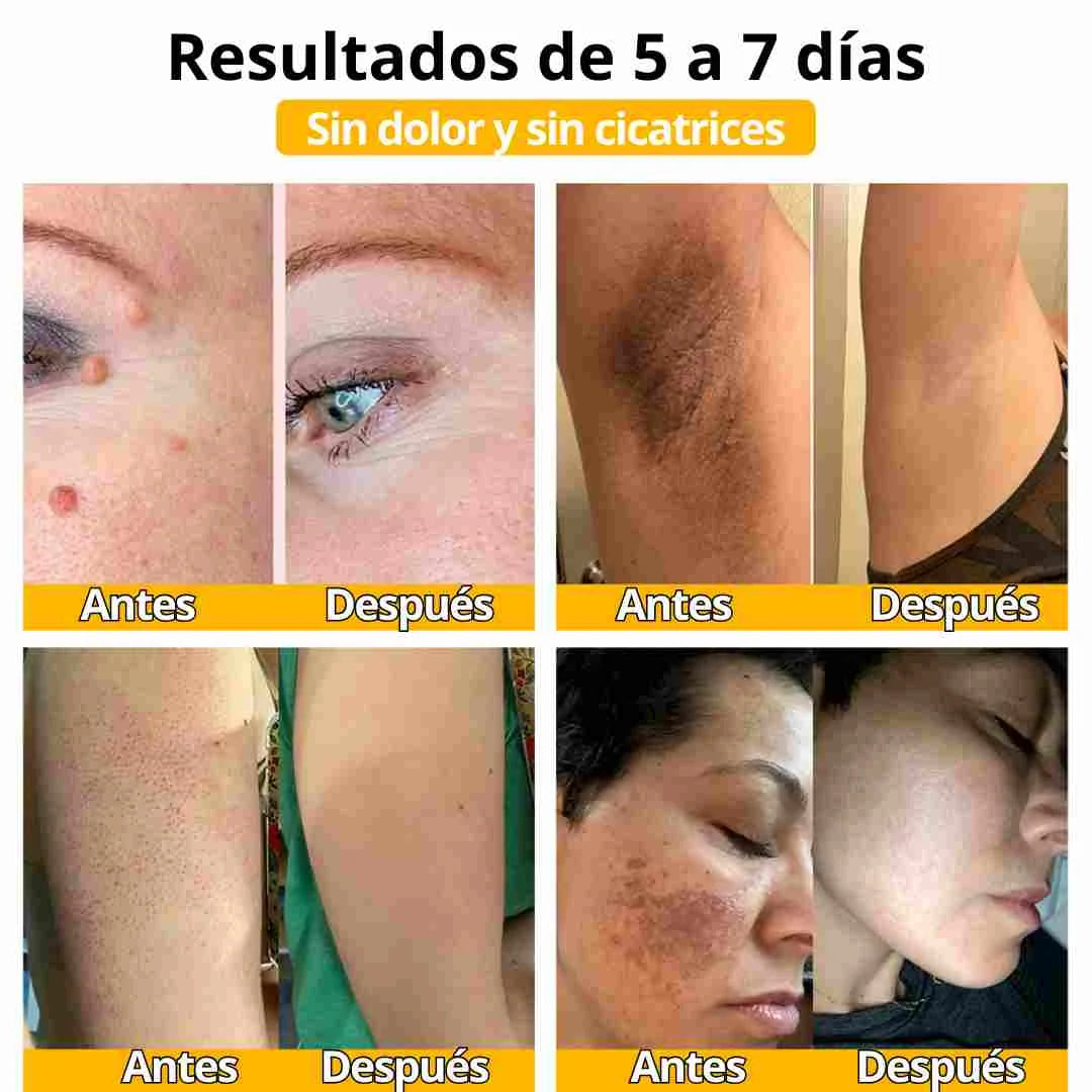 Crema de Veneno de Abeja Pro-Retinol: El Secreto Natural para una Piel Firme y Radiante en Semanas.