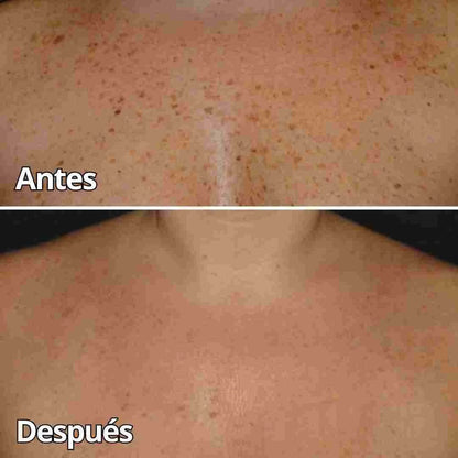 Crema de Veneno de Abeja Pro-Retinol: El Secreto Natural para una Piel Firme y Radiante en Semanas.