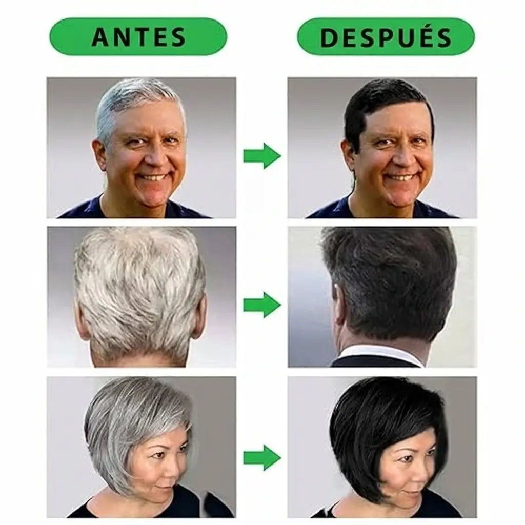Shampoo 3 en 1 Cubre Canas - ¡Tratamiento Diario para tapar las CANAS de Forma Efectiva!