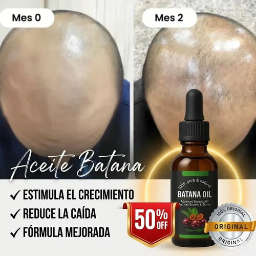 Aceite de Batana ORIGINAL (30ml) + ROMERO | Recupera tu Cabello Perdido EN SOLO 8 SEMANAS.