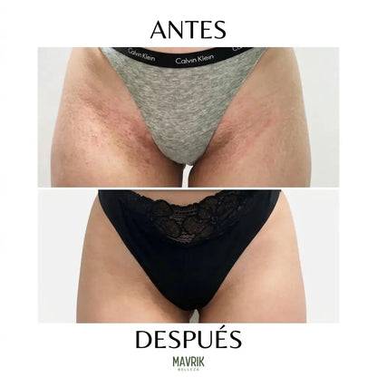 2x1 Jabón de cúrcuma y ácido kójico