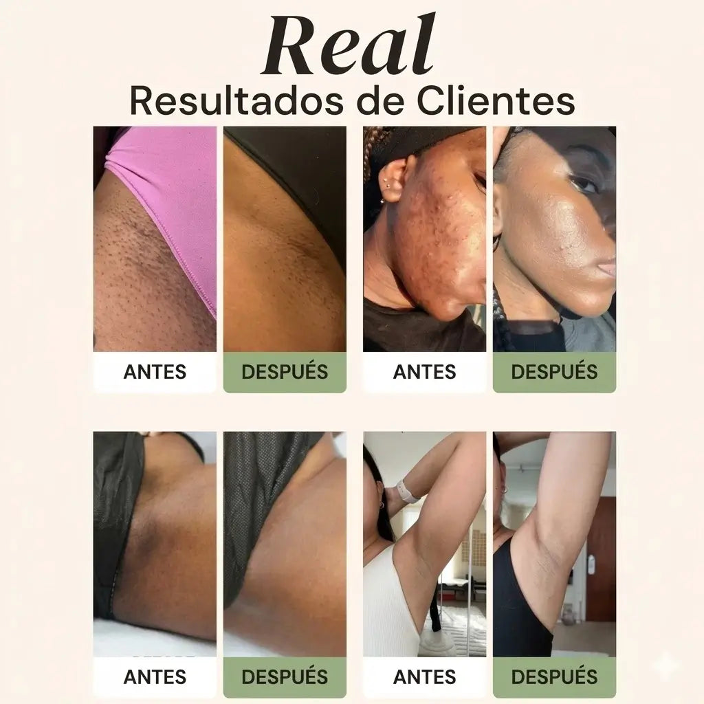 2x1 Jabón de cúrcuma y ácido kójico
