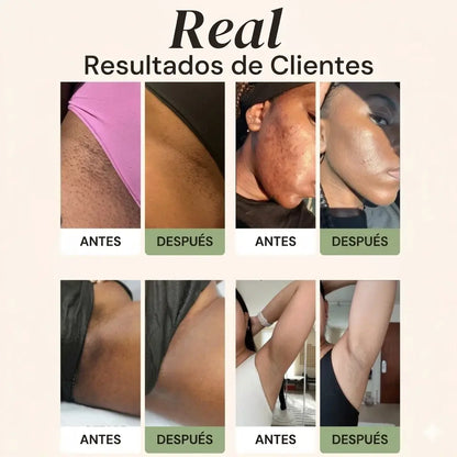 2x1 Jabón de cúrcuma y ácido kójico