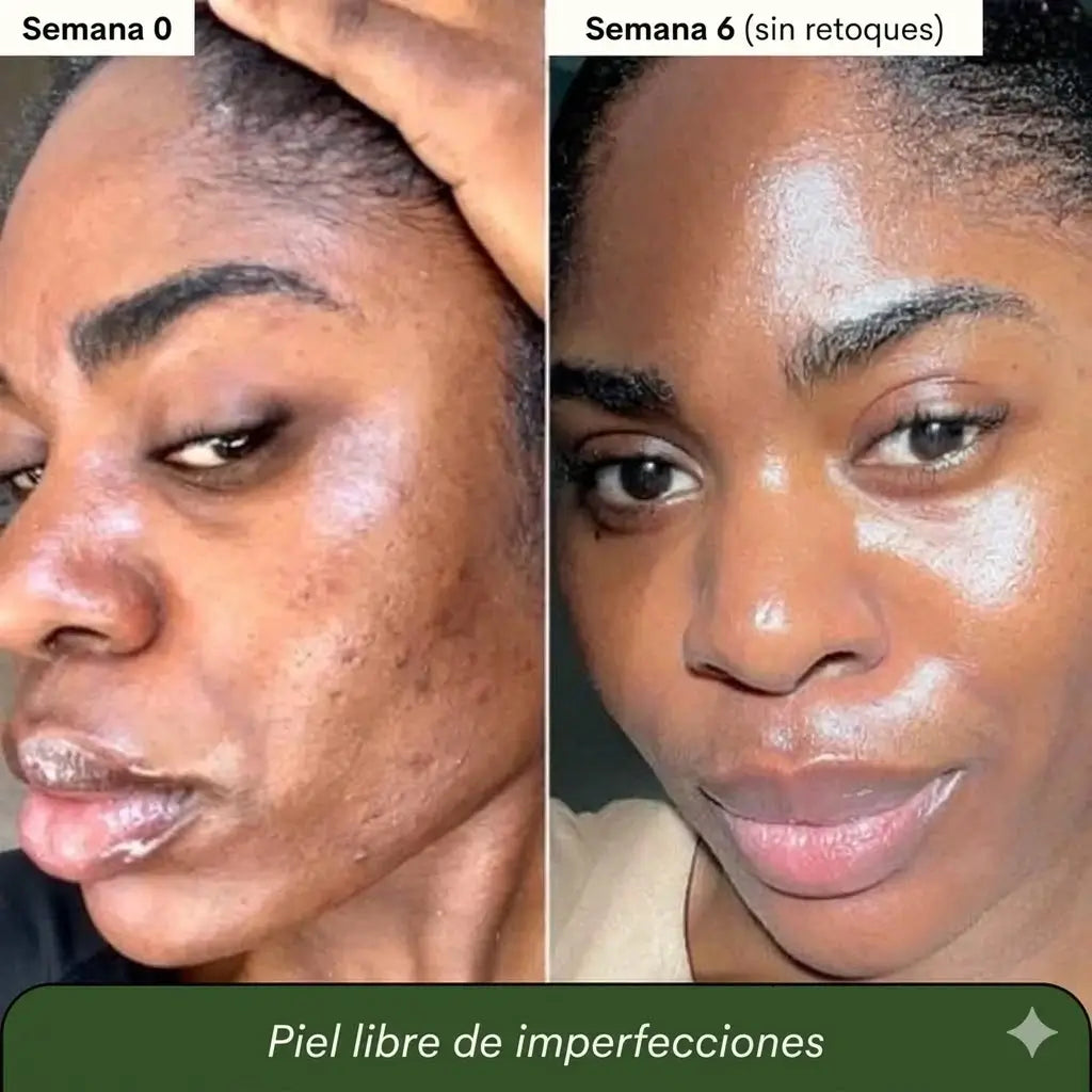 2x1 Jabón de cúrcuma y ácido kójico