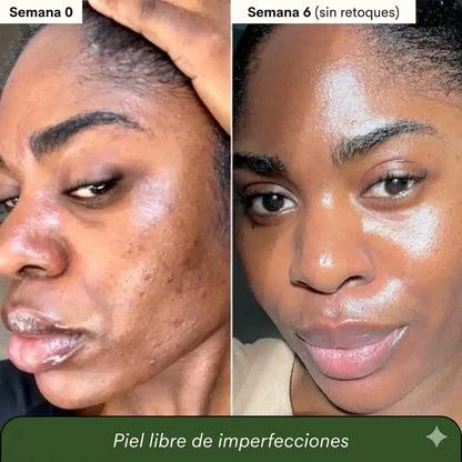 2x1 Jabón de cúrcuma y ácido kójico