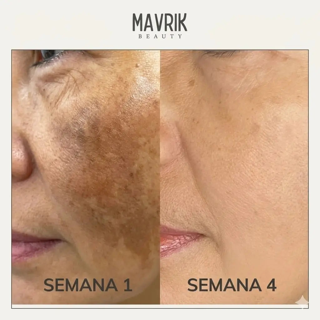 2x1 Jabón de cúrcuma y ácido kójico