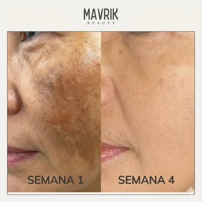 2x1 Jabón de cúrcuma y ácido kójico
