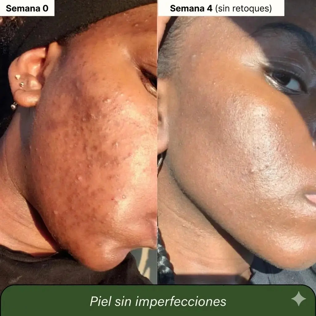 2x1 Jabón de cúrcuma y ácido kójico